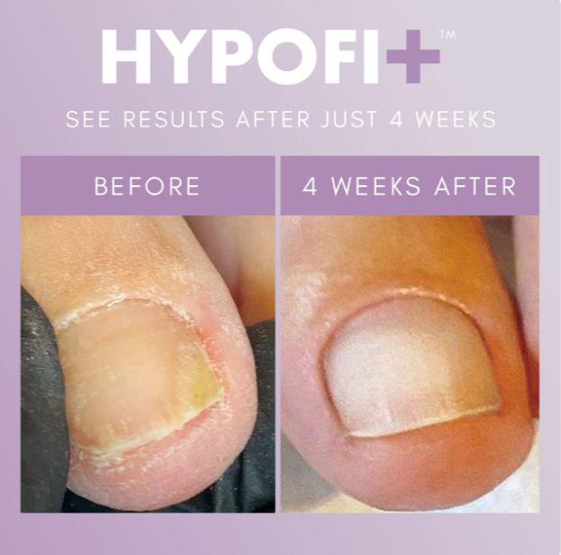 The GelBottle Hypofix™ Repair Serum